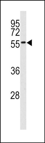 MKNK2 Antibody in Western Blot (WB)