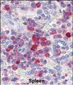 PIM3 Antibody in Immunohistochemistry (Paraffin) (IHC (P))