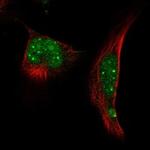 RNF4 Antibody in Immunocytochemistry (ICC/IF)