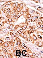 PIKFYVE Antibody in Immunohistochemistry (Paraffin) (IHC (P))