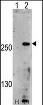 PIKFYVE Antibody in Western Blot (WB)