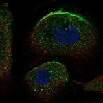 SLC34A2 Antibody in Immunocytochemistry (ICC/IF)