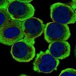 RAPGEF2 Antibody in Immunocytochemistry (ICC/IF)