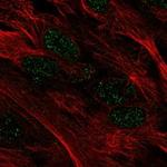 MYOCD Antibody in Immunocytochemistry (ICC/IF)