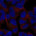 DIO3 Antibody in Immunocytochemistry (ICC/IF)