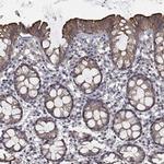 CHST5 Antibody in Immunohistochemistry (Paraffin) (IHC (P))