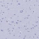 ApoA2 Antibody in Immunohistochemistry (Paraffin) (IHC (P))