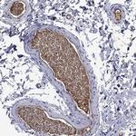 ApoA2 Antibody in Immunohistochemistry (Paraffin) (IHC (P))