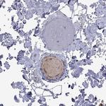 ApoA2 Antibody in Immunohistochemistry (Paraffin) (IHC (P))