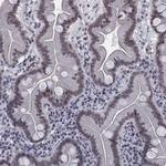 Separase Antibody in Immunohistochemistry (Paraffin) (IHC (P))