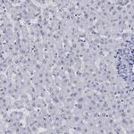 Cyclin A1 Antibody in Immunohistochemistry (Paraffin) (IHC (P))