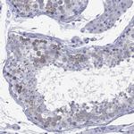 Cyclin A1 Antibody in Immunohistochemistry (Paraffin) (IHC (P))