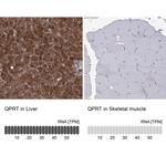 QPRT Antibody in Immunohistochemistry (Paraffin) (IHC (P))