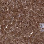 QPRT Antibody in Immunohistochemistry (Paraffin) (IHC (P))