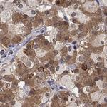 CCDC66 Antibody in Immunohistochemistry (Paraffin) (IHC (P))