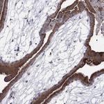 MMAA Antibody in Immunohistochemistry (Paraffin) (IHC (P))