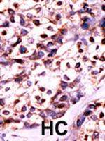 UCK2 Antibody in Immunohistochemistry (Paraffin) (IHC (P))