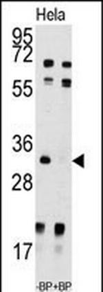 UCK2 Antibody in Western Blot (WB)