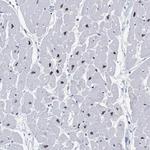 Rbm20 Antibody in Immunohistochemistry (Paraffin) (IHC (P))