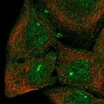 CPEB3 Antibody in Immunocytochemistry (ICC/IF)