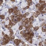 MYO3A Antibody in Immunohistochemistry (Paraffin) (IHC (P))