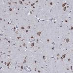 TMEM59 Antibody in Immunohistochemistry (Paraffin) (IHC (P))