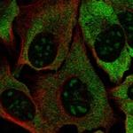 DOHH Antibody in Immunocytochemistry (ICC/IF)