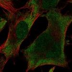 UBXN1 Antibody in Immunocytochemistry (ICC/IF)