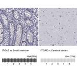 CD103 (Integrin alpha E) Antibody in Immunohistochemistry (Paraffin) (IHC (P))