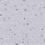 CD103 (Integrin alpha E) Antibody in Immunohistochemistry (Paraffin) (IHC (P))