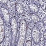 CD103 (Integrin alpha E) Antibody in Immunohistochemistry (Paraffin) (IHC (P))