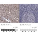 ZIP14 Antibody in Immunohistochemistry (Paraffin) (IHC (P))