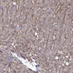 ZIP14 Antibody in Immunohistochemistry (Paraffin) (IHC (P))