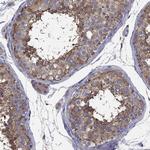 NME5 Antibody in Immunohistochemistry (Paraffin) (IHC (P))