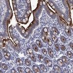 EAAC1 Antibody in Immunohistochemistry (Paraffin) (IHC (P))