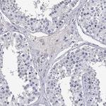 EAAC1 Antibody in Immunohistochemistry (Paraffin) (IHC (P))