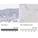 Tyrosinase Antibody in Immunohistochemistry (Paraffin) (IHC (P))