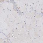 Tyrosinase Antibody in Immunohistochemistry (Paraffin) (IHC (P))