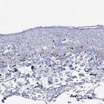 Tyrosinase Antibody in Immunohistochemistry (Paraffin) (IHC (P))