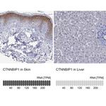 CTNNBIP1 Antibody in Immunohistochemistry (Paraffin) (IHC (P))