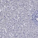 CTNNBIP1 Antibody in Immunohistochemistry (Paraffin) (IHC (P))