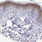 CTNNBIP1 Antibody in Immunohistochemistry (Paraffin) (IHC (P))