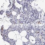 RCAN1 Antibody in Immunohistochemistry (Paraffin) (IHC (P))