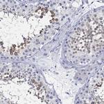 Centrin 1 Antibody in Immunohistochemistry (Paraffin) (IHC (P))