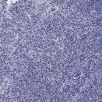 Centrin 1 Antibody in Immunohistochemistry (Paraffin) (IHC (P))