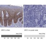 Glypican 1 Antibody in Immunohistochemistry (Paraffin) (IHC (P))