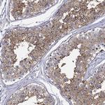 Glypican 1 Antibody in Immunohistochemistry (Paraffin) (IHC (P))