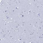 DPP4 Antibody in Immunohistochemistry (Paraffin) (IHC (P))