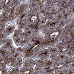 DPP4 Antibody in Immunohistochemistry (Paraffin) (IHC (P))