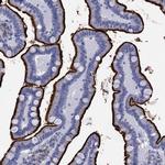 DPP4 Antibody in Immunohistochemistry (Paraffin) (IHC (P))